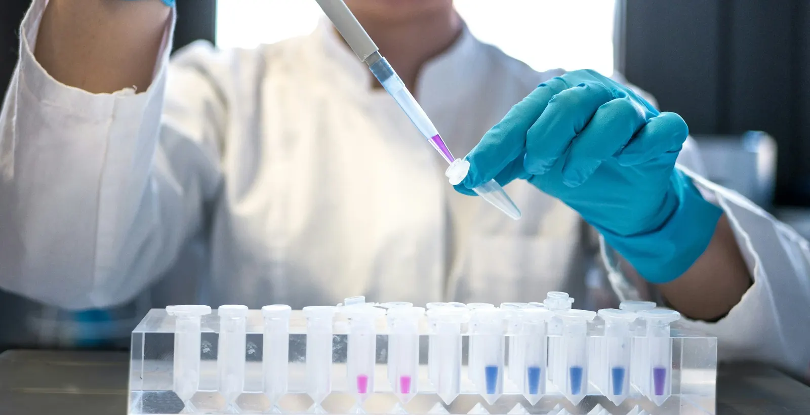 Laboratuvarda pipetle numune hazırlayan eldivenli eller